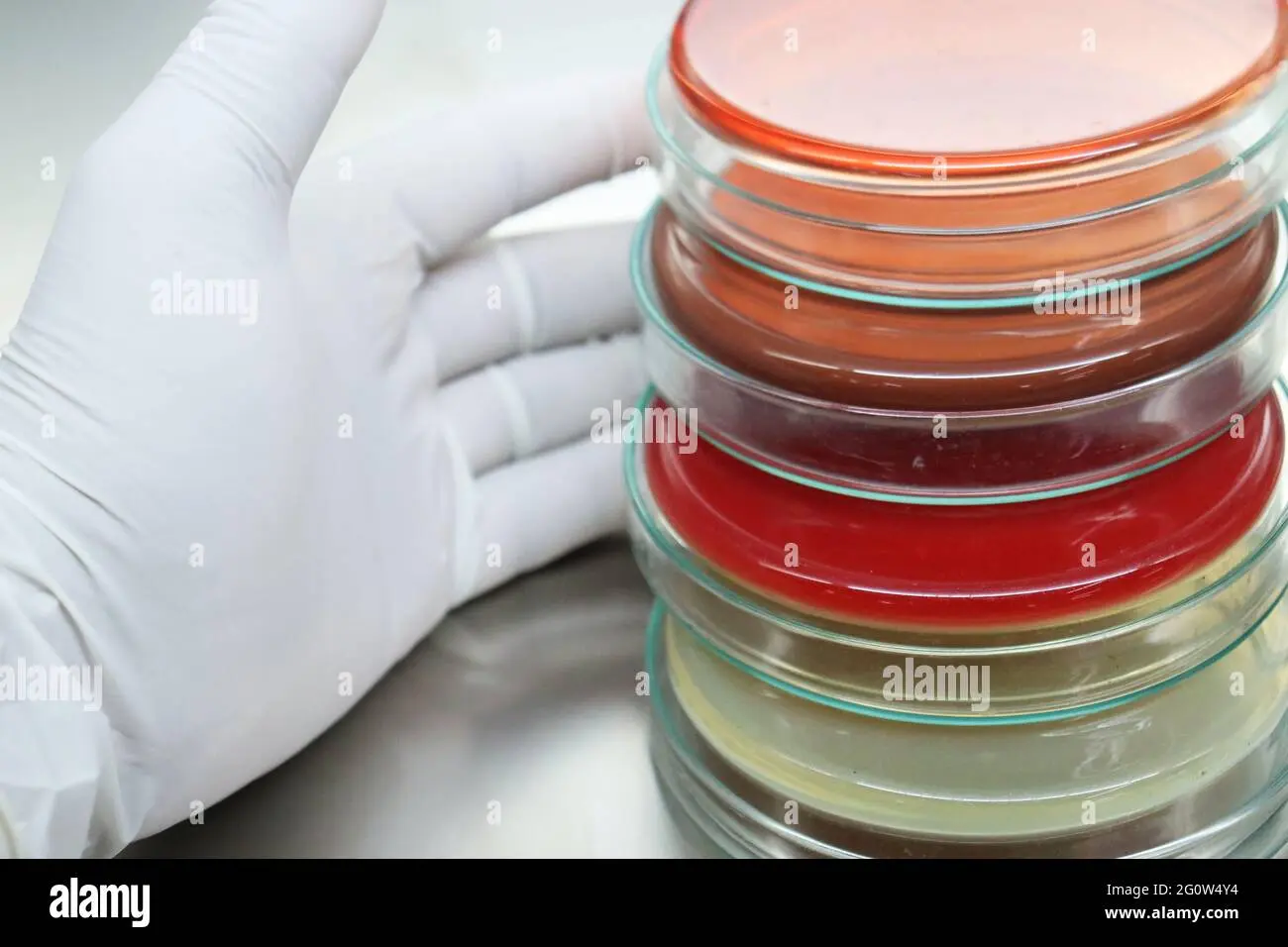 placas de petri con medio sólido - Qué tipos de placas Petri existen y sus medidas
